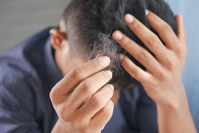 Understanding Causes of Hair Loss - Why is my Hair Falling Out?