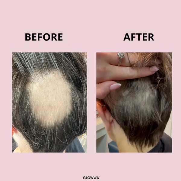 Before and after comparison of hair treatment on a pink background, showing a person with gray hair.