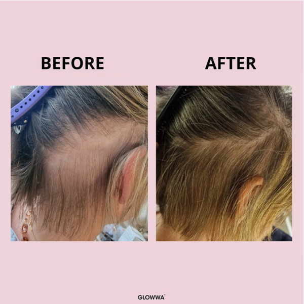 Before and after comparison of hair treatment with 'GLOWWA' branding on a pink background.