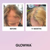 Before and after comparison of hair growth with 'GLOWWA' branding on a pink background.
