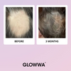 Before and after comparison of hair treatment with 'GLOWWA' branding on a light purple background.
