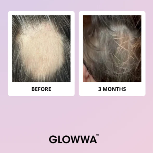 Before and after comparison of hair treatment with 'GLOWWA' branding on a light purple background.